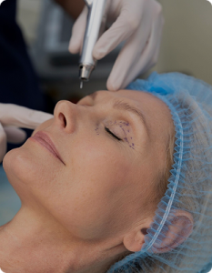 skin-tightening-rejuvenation