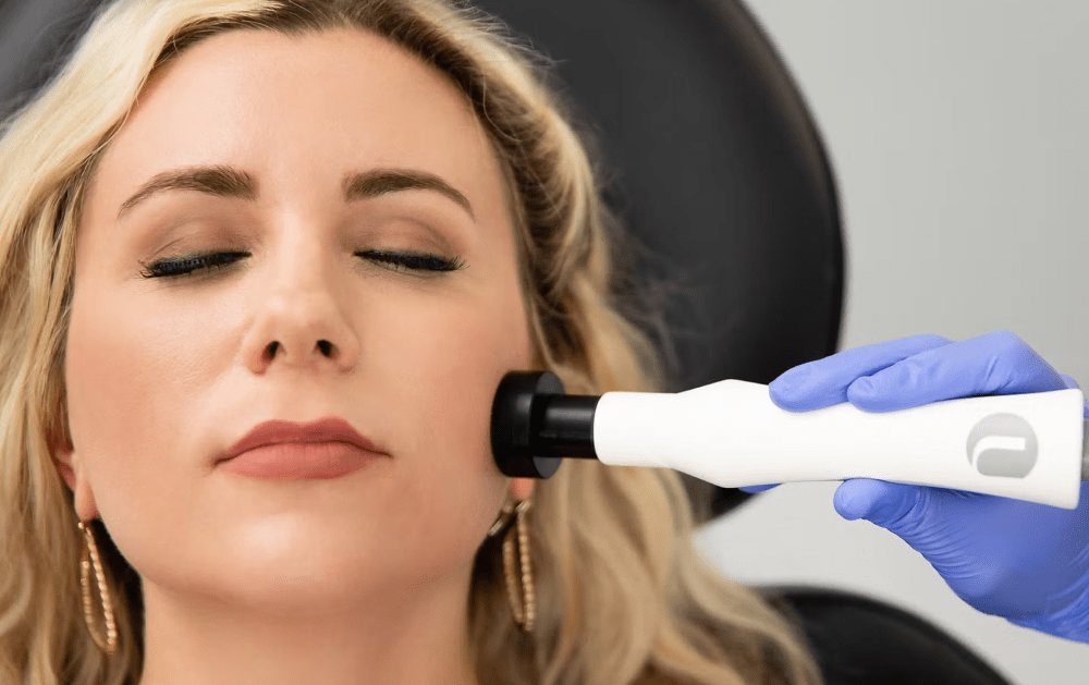 NuEra RF Skin Tightening: The Non-Surgical Facelift