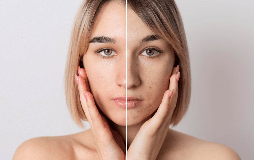Clear & Even Skin: Your Skin Pigmentation Treatment Specialist in Lake Zurich, IL