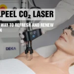 CoolPeel CO₂ Laser: A Gentle Way to Refresh and Renew Your Skin